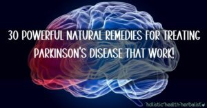30 Powerful Natural Remedies for Treating...